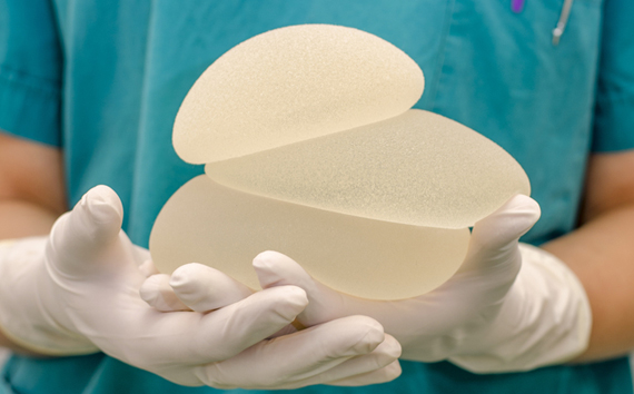 Silicone gel implants
