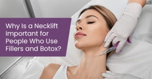 Why is a necklift important for people who use fillers and botox?
